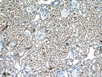 GALNT3 Antibody in Immunohistochemistry (Paraffin) (IHC (P))