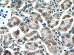 GALNT3 Antibody in Immunohistochemistry (Paraffin) (IHC (P))