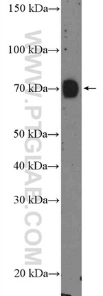 GALNT3 Antibody in Western Blot (WB)