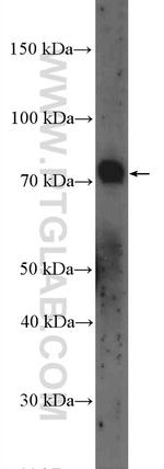 GALNT3 Antibody in Western Blot (WB)