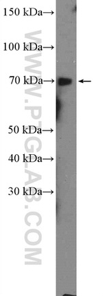 GALNT3 Antibody in Western Blot (WB)