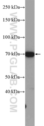 GALNT3 Antibody in Western Blot (WB)