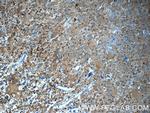 ARPC5 Antibody in Immunohistochemistry (Paraffin) (IHC (P))