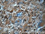 ARPC5 Antibody in Immunohistochemistry (Paraffin) (IHC (P))