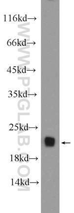 ARPC5 Antibody in Western Blot (WB)