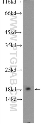 ARPC5 Antibody in Western Blot (WB)