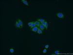 NDUFB11 Antibody in Immunocytochemistry (ICC/IF)