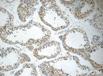 NDUFB11 Antibody in Immunohistochemistry (Paraffin) (IHC (P))