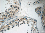 NDUFB11 Antibody in Immunohistochemistry (Paraffin) (IHC (P))