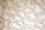 NDUFB11 Antibody in Immunohistochemistry (Paraffin) (IHC (P))