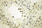 NDUFB11 Antibody in Immunohistochemistry (Paraffin) (IHC (P))