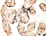 ANTXR2 Antibody in Immunohistochemistry (Paraffin) (IHC (P))