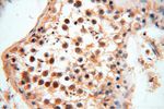 ANTXR2 Antibody in Immunohistochemistry (Paraffin) (IHC (P))