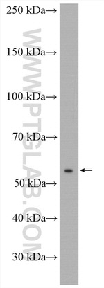 ANTXR2 Antibody in Western Blot (WB)