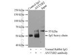 ANTXR2 Antibody in Immunoprecipitation (IP)