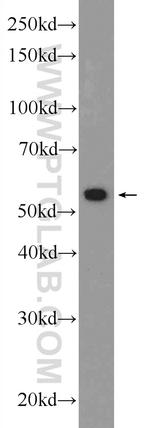 ANTXR2 Antibody in Western Blot (WB)