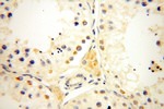 CPOX Antibody in Immunohistochemistry (Paraffin) (IHC (P))