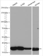 CPOX Antibody in Western Blot (WB)