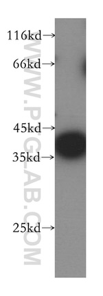 CPOX Antibody in Western Blot (WB)