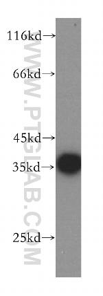 CPOX Antibody in Western Blot (WB)