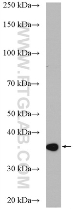 CPOX Antibody in Western Blot (WB)