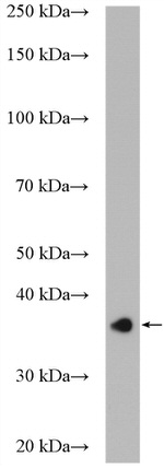 CPOX Antibody in Western Blot (WB)