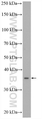 CPOX Antibody in Western Blot (WB)