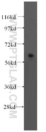 TRMT6 Antibody in Western Blot (WB)