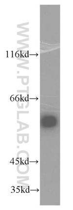 TRMT6 Antibody in Western Blot (WB)