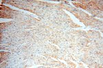 EXOSC10 Antibody in Immunohistochemistry (Paraffin) (IHC (P))