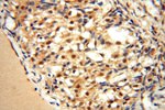 EXOSC10 Antibody in Immunohistochemistry (Paraffin) (IHC (P))