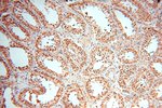 EXOSC10 Antibody in Immunohistochemistry (Paraffin) (IHC (P))