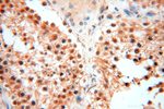 EXOSC10 Antibody in Immunohistochemistry (Paraffin) (IHC (P))