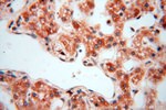 EXOSC10 Antibody in Immunohistochemistry (Paraffin) (IHC (P))