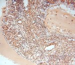 EXOSC10 Antibody in Immunohistochemistry (Paraffin) (IHC (P))