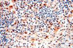 EXOSC10 Antibody in Immunohistochemistry (Paraffin) (IHC (P))