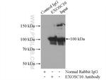 EXOSC10 Antibody in Immunoprecipitation (IP)