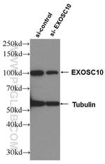 EXOSC10 Antibody in Western Blot (WB)