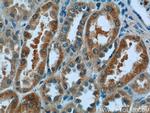 N4BP3 Antibody in Immunohistochemistry (Paraffin) (IHC (P))