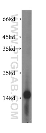 MRPS16 Antibody in Western Blot (WB)