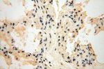 TASP1 Antibody in Immunohistochemistry (Paraffin) (IHC (P))