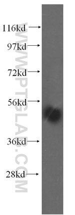 TASP1 Antibody in Western Blot (WB)