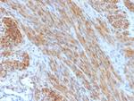 Desmin (Muscle Cell Marker) Antibody in Immunohistochemistry (Paraffin) (IHC (P))