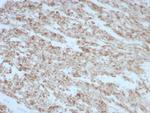 Desmin (Muscle Cell Marker) Antibody in Immunohistochemistry (Paraffin) (IHC (P))