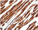 Desmin (Muscle Cell Marker) Antibody in Immunohistochemistry (Paraffin) (IHC (P))