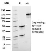 Desmin (Muscle Cell Marker) Antibody in SDS-PAGE (SDS-PAGE)