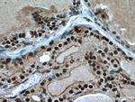 TBX3 Antibody in Immunohistochemistry (Paraffin) (IHC (P))