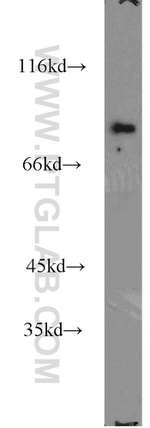 TBX3 Antibody in Western Blot (WB)