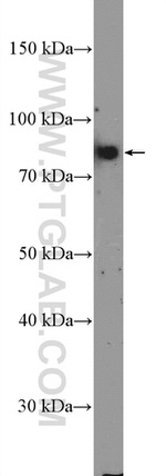 TBX3 Antibody in Western Blot (WB)