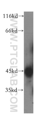 ACAD8 Antibody in Western Blot (WB)